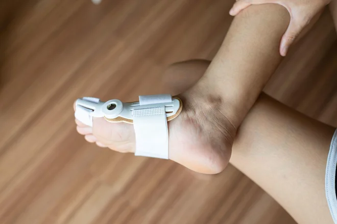 Nočna opornica za hallux valgus